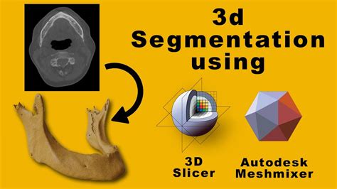 dicom to stl 3d slicer